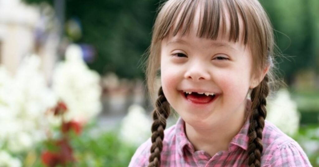 salud oral para niños con síndrome de Down