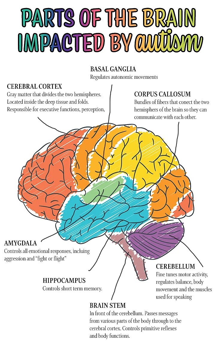 Partes del cerebro afectadas por el autismo